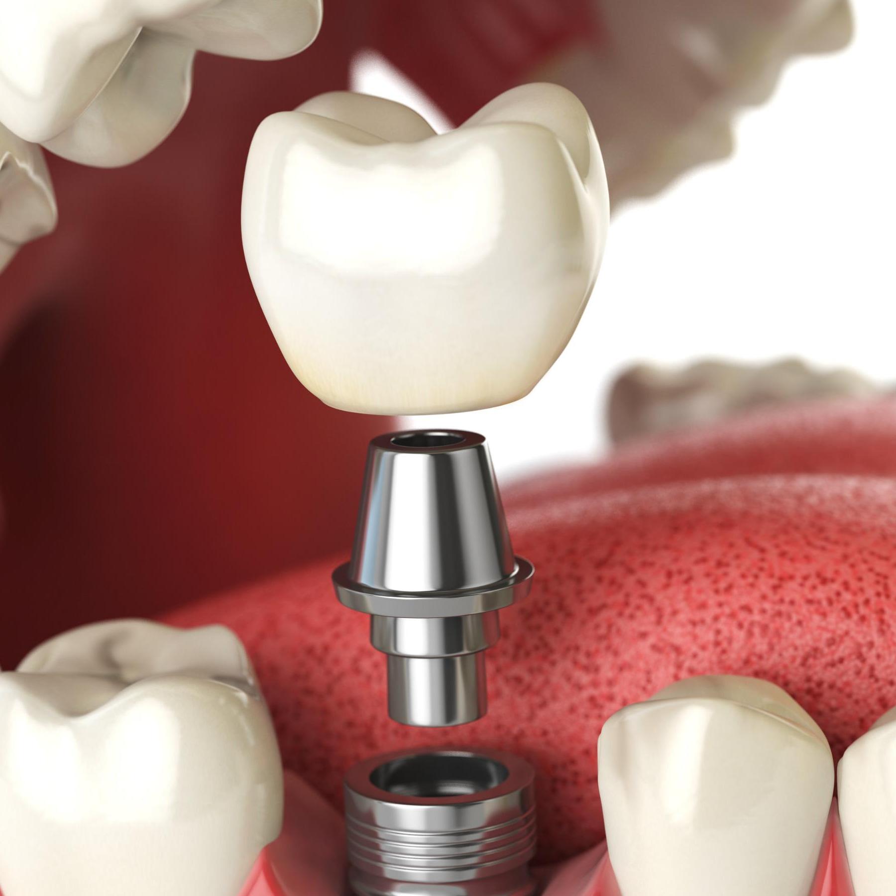 illumeadvdentistry